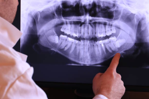 Best Root Canal Emergency Dentist  in Richmond, TX